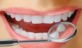 Snowhite Teeth Whitening – Hrvatska – recenzije – forum