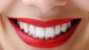 Snowhite Teeth Whitening  - Izbjeljivanje zubi – ljekarna – cijena – Amazon
